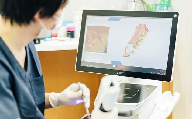 口腔内スキャナーの写真