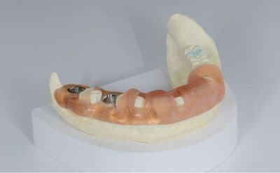 ガイデットサージェリー