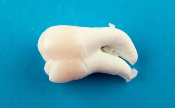 親知らずの写真